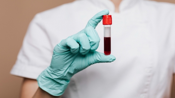 Korzyści z kompleksowych badań krwi