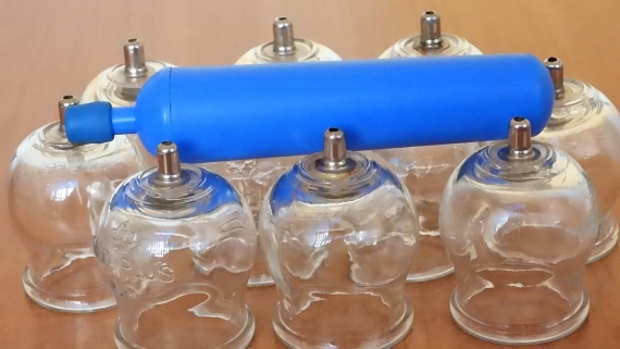 Czy stawianie baniek jest skuteczne?